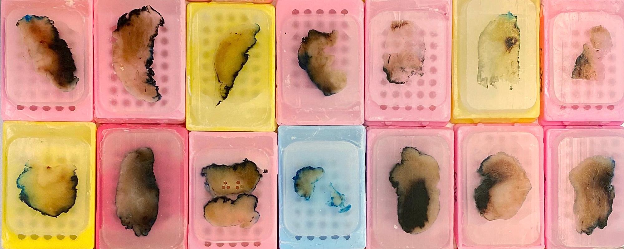 Illustrasjons-/bannerbilde for Experimental Health Research Conference (EHRC) - M&iacute;misbrunnr 2023